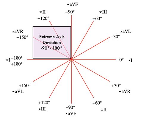 Axial Deviation Tester|extreme axis deviation meaning.